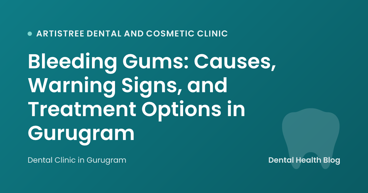 Bleeding Gums: Causes, Warning Signs, and Treatment Options in Gurugram