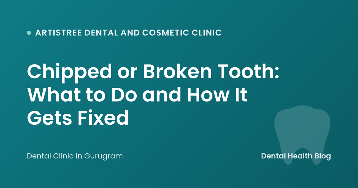 Chipped or Broken Tooth: What to Do and How It Gets Fixed
