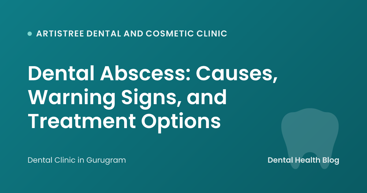 Dental Abscess: Causes, Warning Signs, and Treatment Options