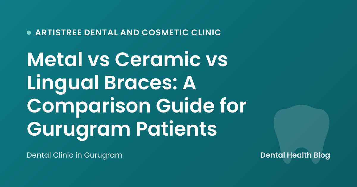 Metal vs Ceramic vs Lingual Braces: A Comparison Guide for Gurugram Patients