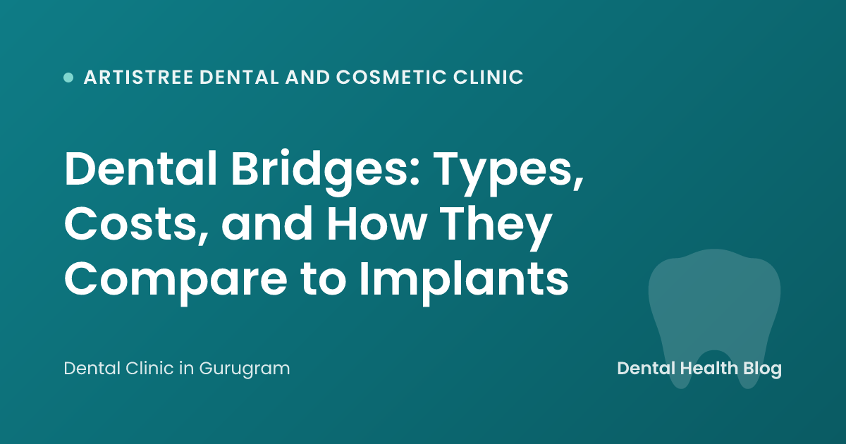 Dental Bridges: Types, Costs, and How They Compare to Implants