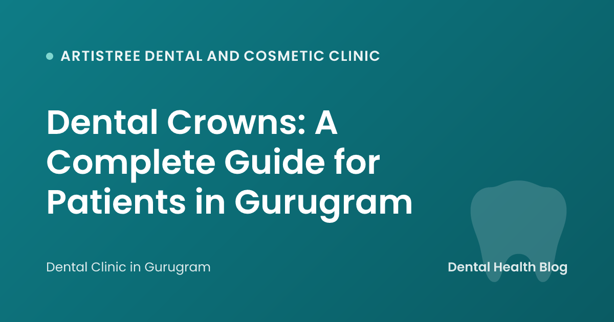 Dental Crowns: A Complete Guide for Patients in Gurugram