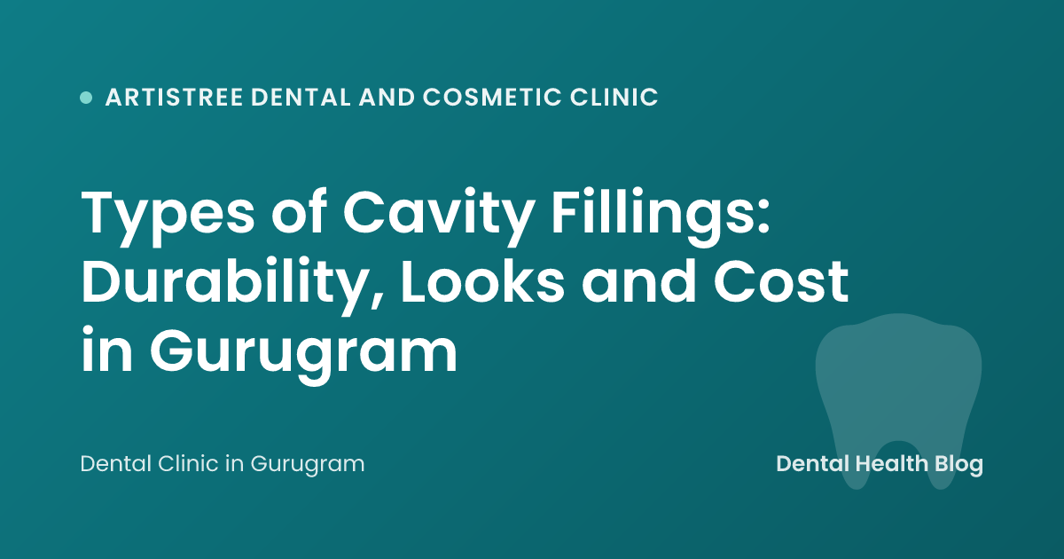 Types of Cavity Fillings: Durability, Looks and Cost in Gurugram
