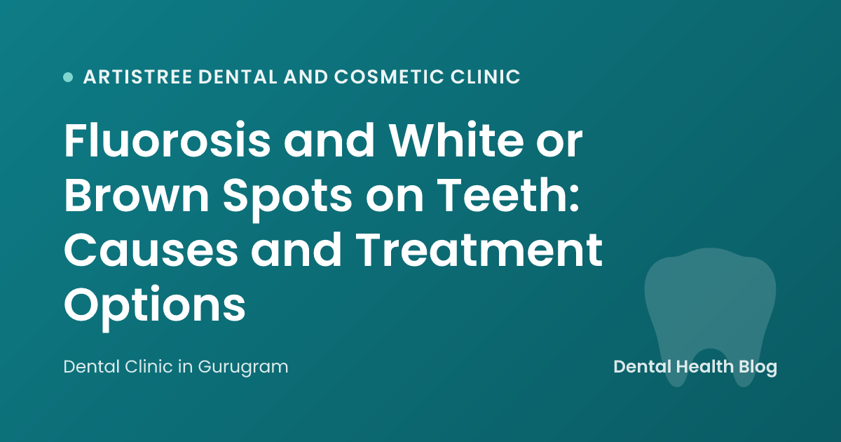 Fluorosis and White or Brown Spots on Teeth: Causes and Treatment Options