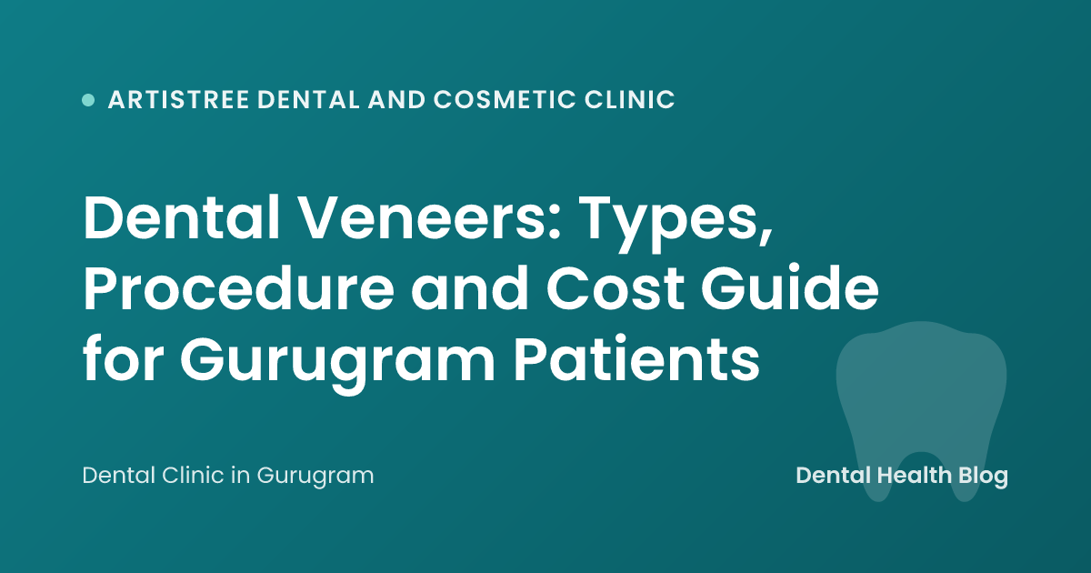 Dental Veneers: Types, Procedure and Cost Guide for Gurugram Patients