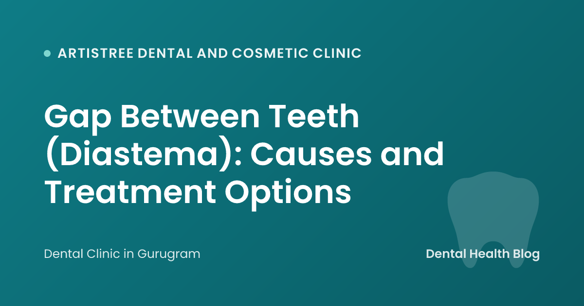 Gap Between Teeth (Diastema): Causes and Treatment Options