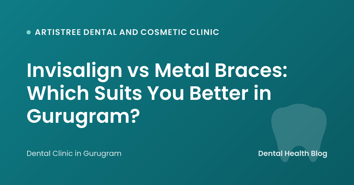 Invisalign vs Metal Braces: Which Suits You Better in Gurugram?