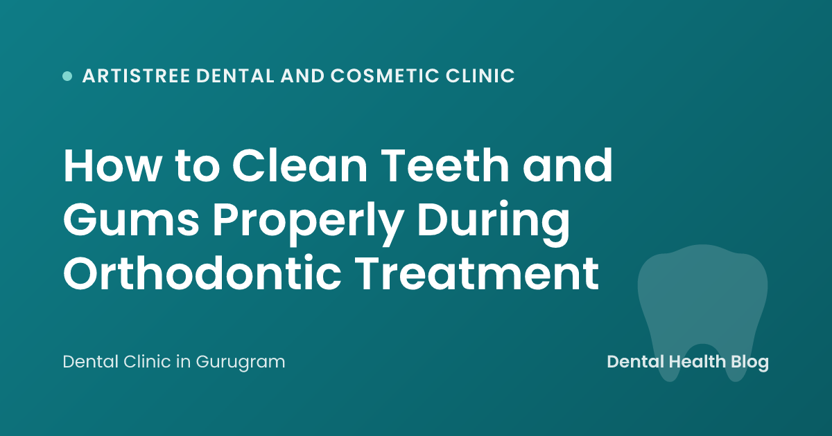 How to Clean Teeth and Gums Properly During Orthodontic Treatment