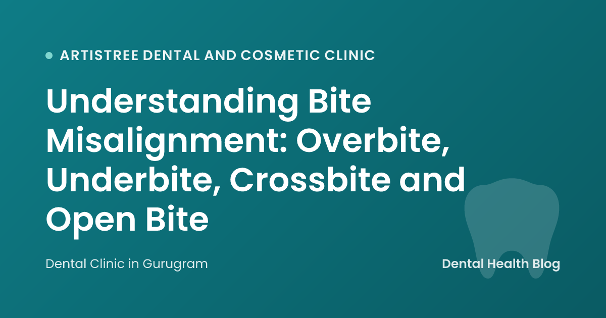 Understanding Bite Misalignment: Overbite, Underbite, Crossbite and Open Bite