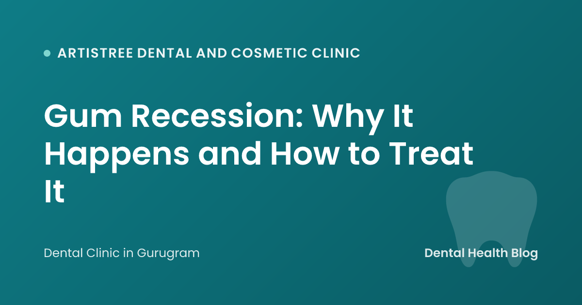 Gum Recession: Why It Happens and How to Treat It