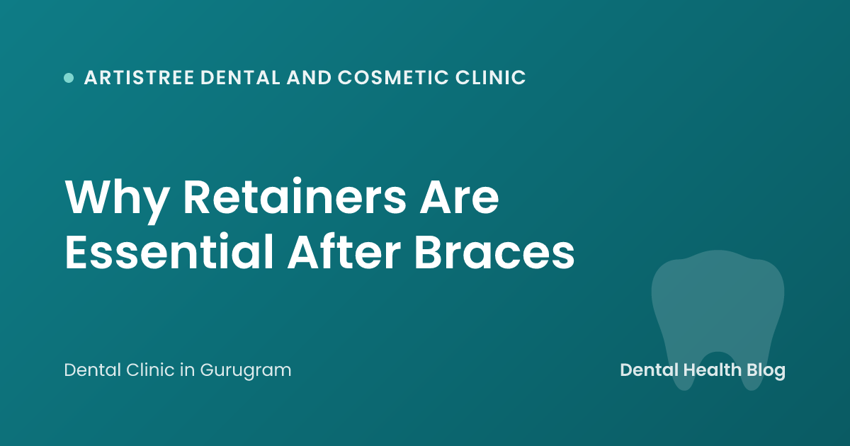 Why Retainers Are Essential After Braces
