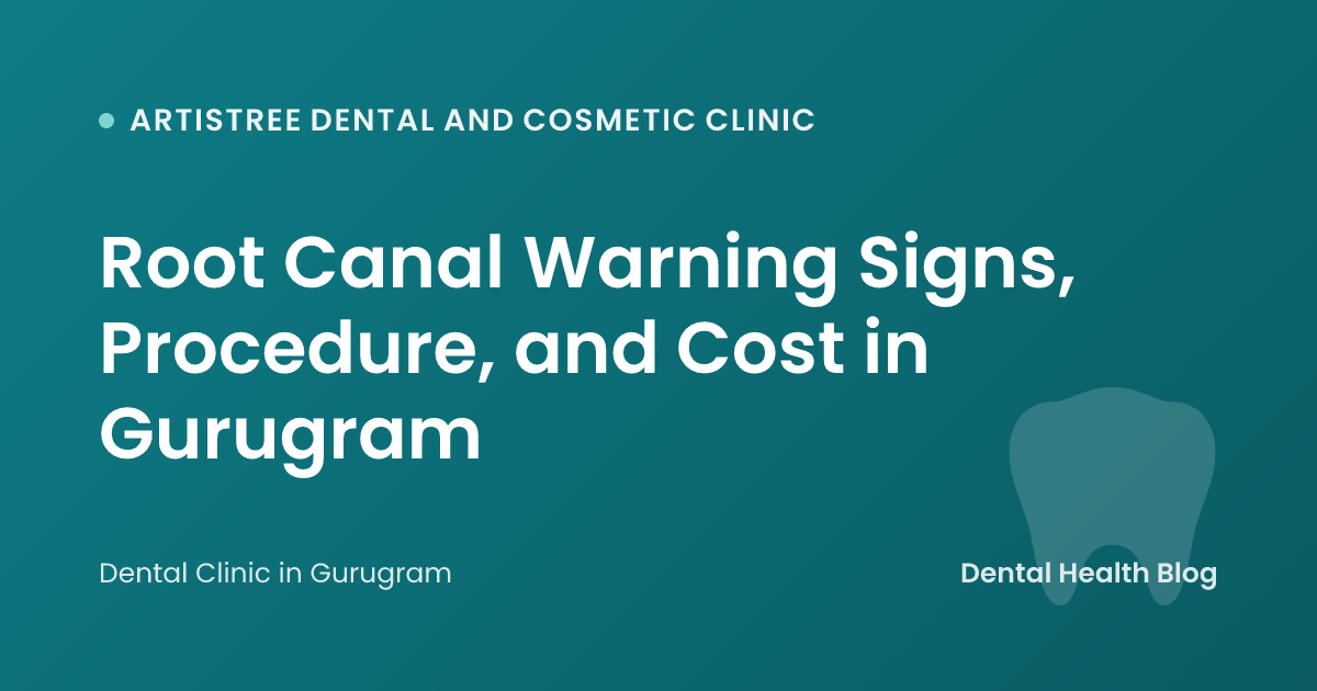 Root Canal Warning Signs, Procedure, and Cost in Gurugram