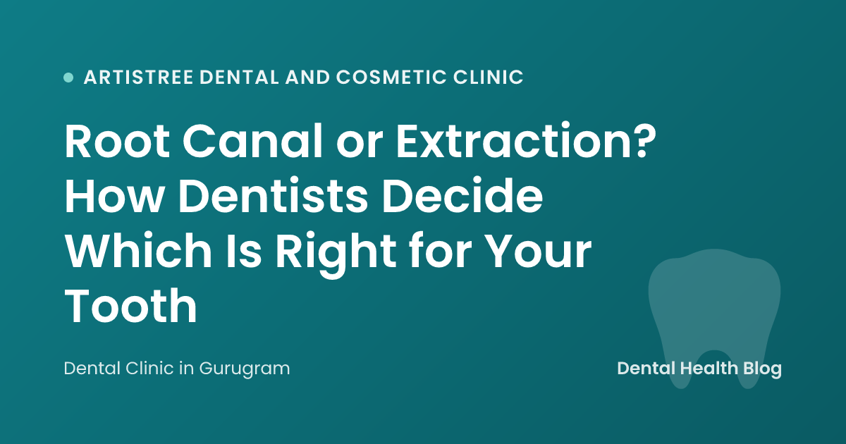 Root Canal or Extraction? How Dentists Decide Which Is Right for Your Tooth
