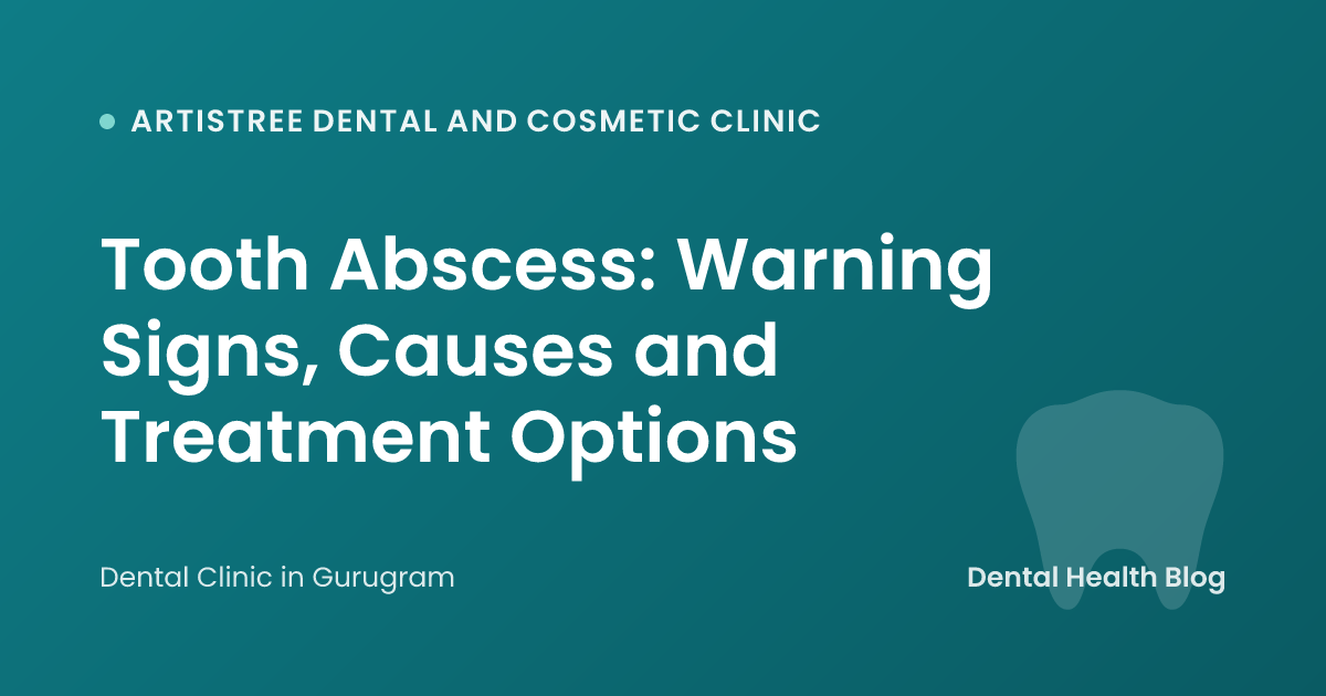 Tooth Abscess: Warning Signs, Causes and Treatment Options