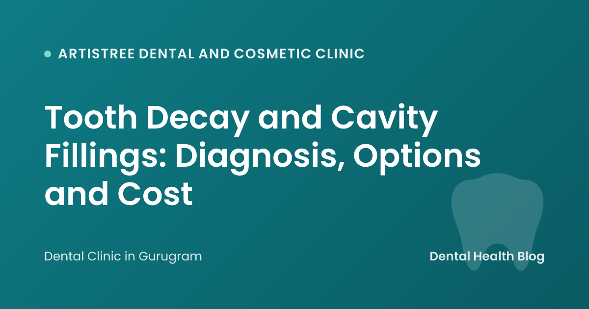 Tooth Decay and Cavity Fillings: Diagnosis, Options and Cost
