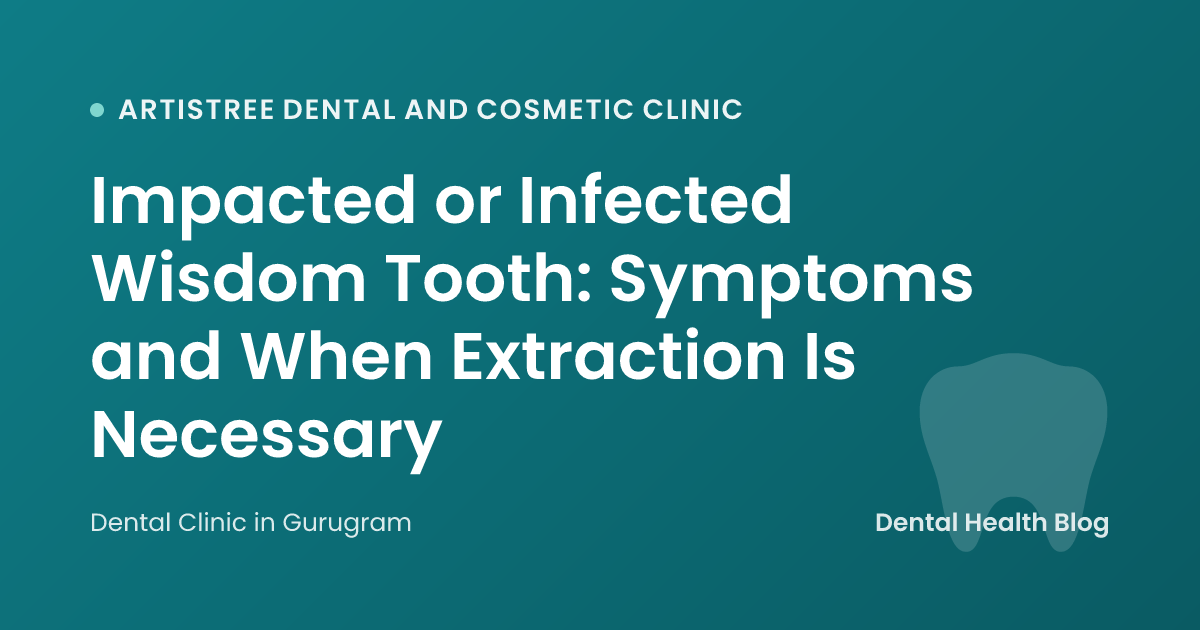 Impacted or Infected Wisdom Tooth: Symptoms and When Extraction Is Necessary