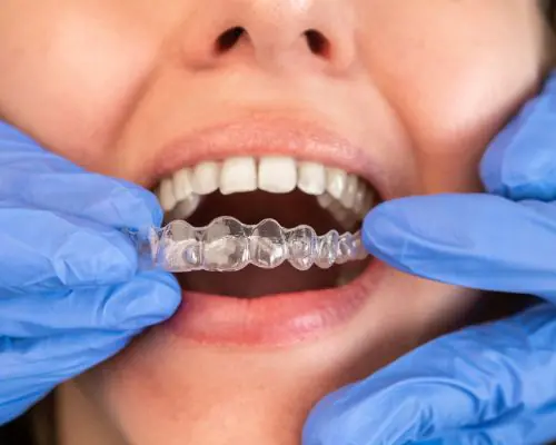 Fixed Teeth