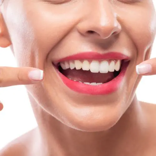 Fixed Teeth
