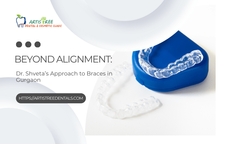 Braces Treatment In Gurgaon