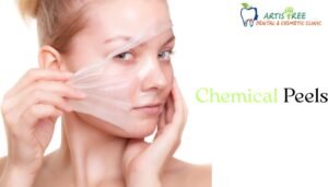 chemical peel treatment in gurgaon