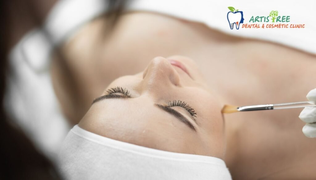 chemical peel treatment in gurgaon