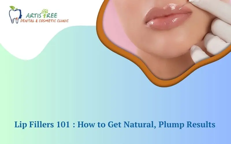 Lip Fillers 101 How to Get Natural, Plump Results