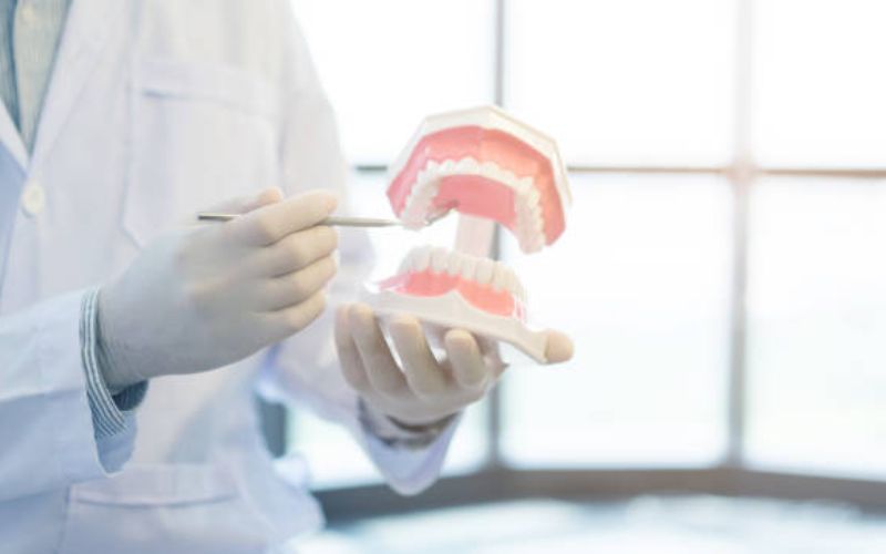 gum treatment in gurgaon