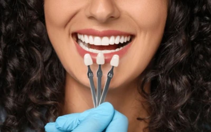 dental crown