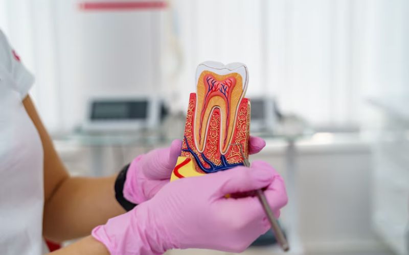 root canal treatment
