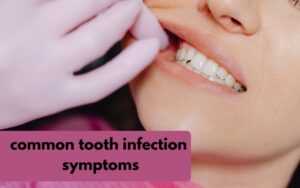 common tooth infection symptoms